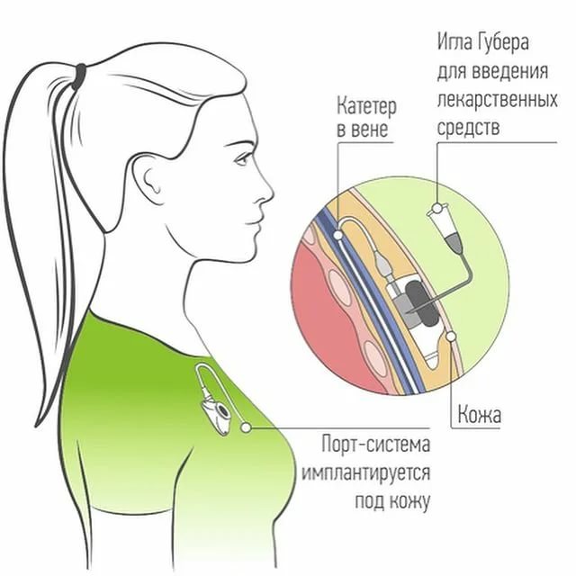 Как пользоваться и ухаживать за порт-системой